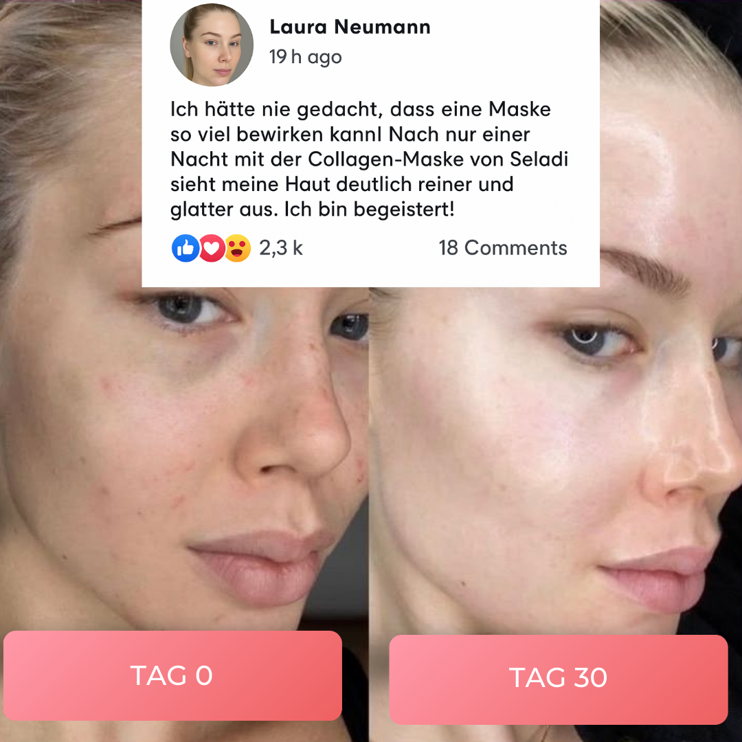 Collagené by Seladi™ | Virale Kollagen Maske