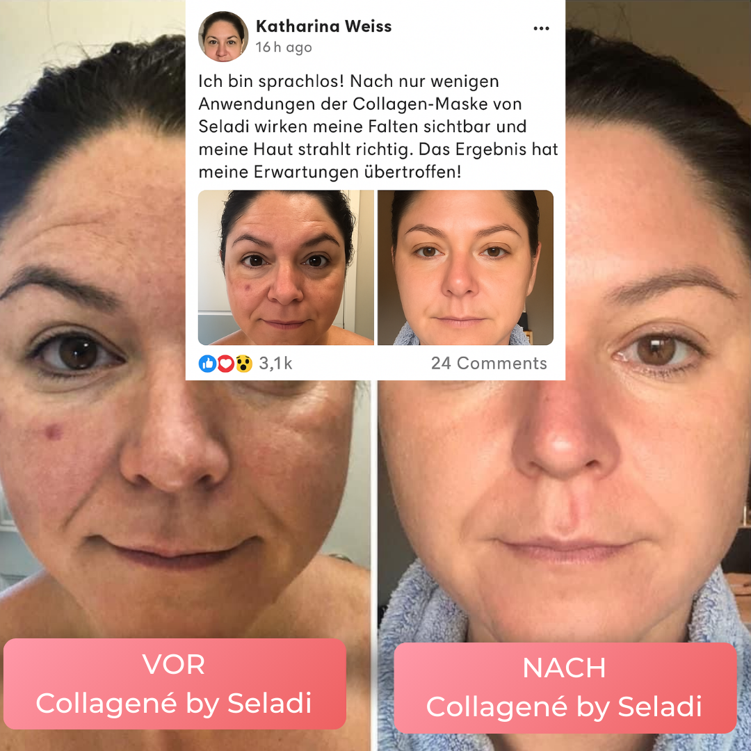 Collagené by Seladi™ | Virale Kollagen Maske