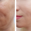 Luminous Mask™ | Rotlicht-Therapie Maske