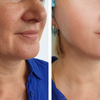 Luminous Mask™ | Rotlicht-Therapie Maske