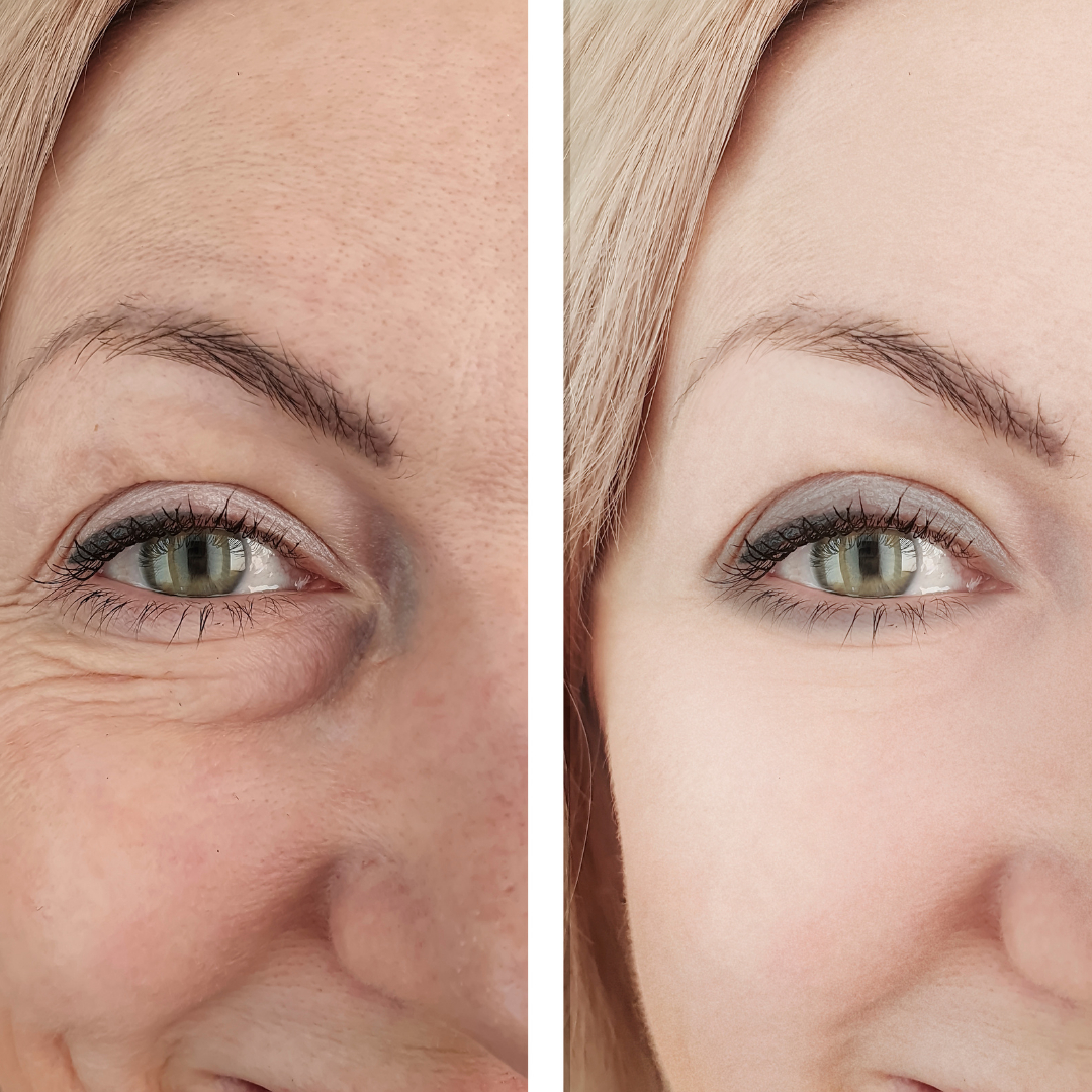Luminous Mask™ | Rotlicht-Therapie Maske