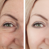 Luminous Mask™ | Rotlicht-Therapie Maske