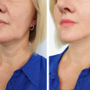 Luminous Mask™ | Rotlicht-Therapie Maske